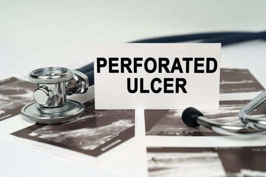 Medical concept. On the ultrasound pictures there is a stethoscope and a business card with the inscription - Perforated ulcer