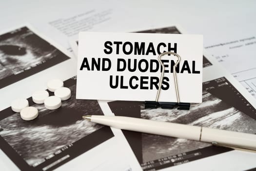 Medical concept. On the ultrasound pictures there is a pen and a business card with the inscription - Stomach and duodenal ulcers