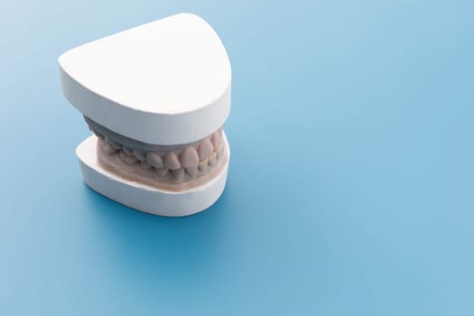 Dental Mold, Gypsum Model Plaster Cast For Teeth Molar In Laboratory On Blue Background. Human Jaw. Preparing Invisible Braces, Aligner Or Night Guard For Bruxism, Dentures. Copy Space For Text