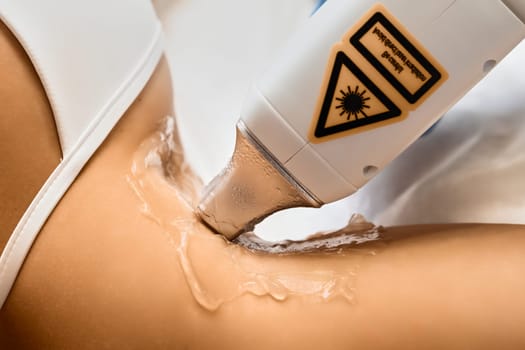 Close up woman having laser hair removal procedure on armpits in beauty salon