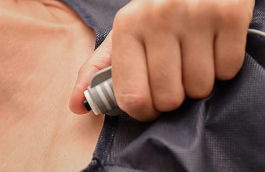 The woman push a button for a regular dose of epidural anesthesia