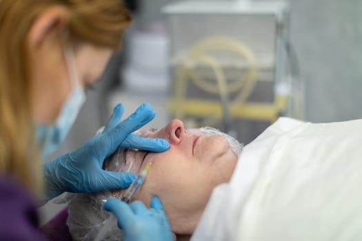 An experienced beautician performs needle mesotherapy for the client. Close-up of the face of a mature woman lying on a cosmetic bed. The beautician inserts a needle into the skin of the woman's face.