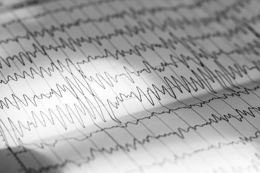 Electroencephalogram result on paper close up, brain activity test, diagnosis of epilepsy