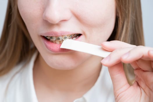 Young woman with metal braces on her teeth is chewing gum