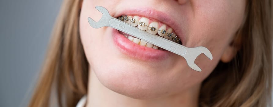 Close-up portrait of a woman with braces holding a wrench in her teeth