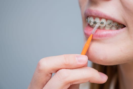 Unrecognizable Caucasian woman cleans braces with a brush. Close-up of female teeth with brackets.