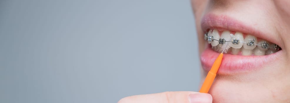 Unrecognizable Caucasian woman cleans braces with a brush. Widescreen