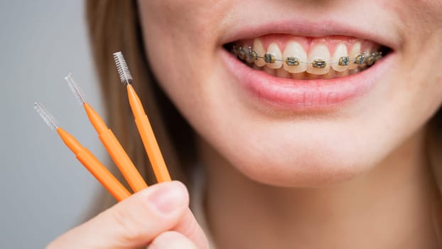 Close-up portrait of a woman with braces holding a floss to clean her teeth