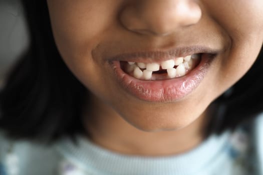 detail shot of child with teeth missing.