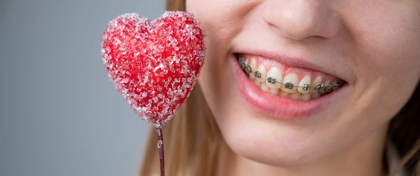 Cute woman with braces on her teeth holds a candy in the form of a heart on white background. Widescreen