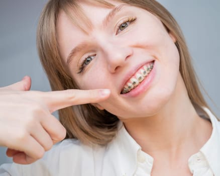 A beautiful red-haired girl smiles and points to the braces. Young woman corrects bite with orthodontic appliance.