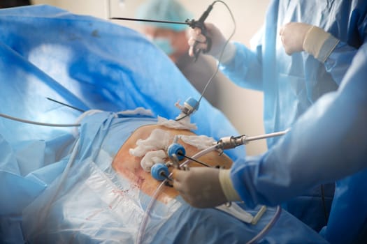 doctors perform laparoscopy operations in the intensive care unit. High quality photo