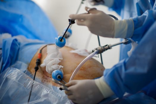 doctors perform laparoscopy operations in the intensive care unit. High quality photo