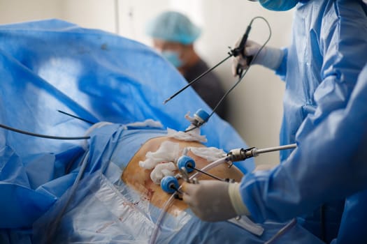 doctors perform laparoscopy operations in the intensive care unit. High quality photo