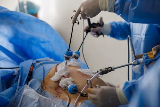 doctors perform laparoscopy operations in the intensive care unit. High quality photo