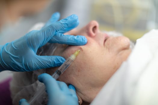Close-up of an elderly woman's face seen in profile. The woman is lying down and has an injection performed in the skin of her face. The injection is performed by a person wearing blue disposable gloves. Only her hands are visible.