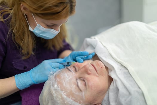 A patient of an aesthetic medicine clinic experiences a mesotherapy treatment. An overhead view of the woman lying down. Fresh injection marks can be seen on her face.