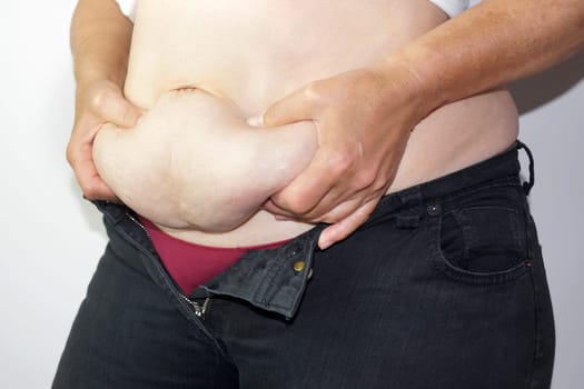 woman holding a fold of fat on her stomach with her hands.