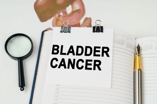 Medical concept. On the table there is a magnifying glass and a notepad with the inscription - Bladder cancer