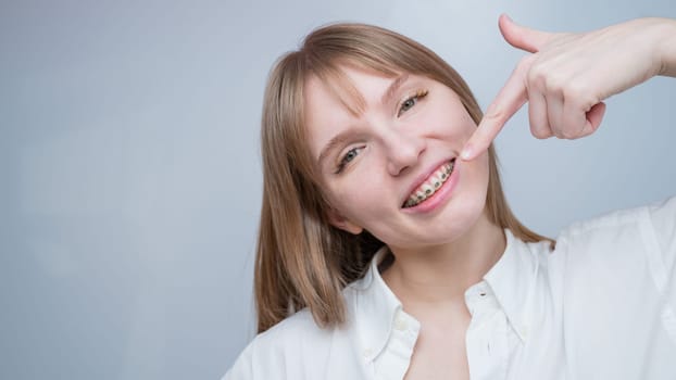 A beautiful red-haired girl smiles and points to the braces. Young woman corrects bite with orthodontic appliance.