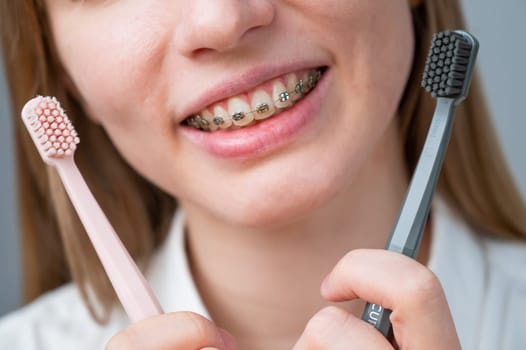 Cropped portrait of young smiling woman with braces holding two toothbrushes