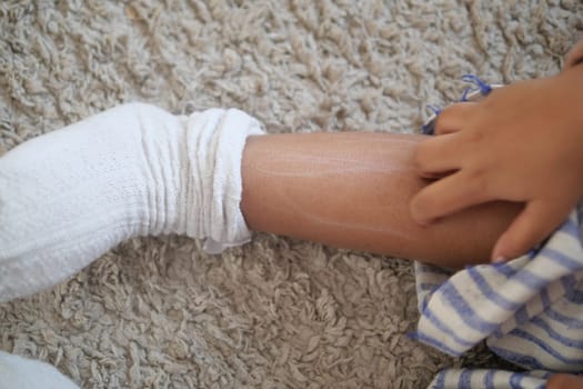 child suffering from itching skin on feet .
