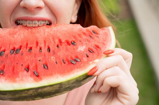 Close-up portrait of red-haired young woman with braces eating watermelon outdoors.