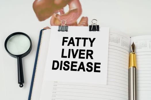Medical concept. On the table there is a magnifying glass and a notepad with the inscription - Fatty liver disease