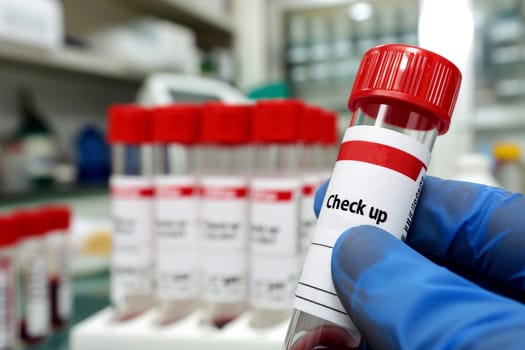 Doctor holding blood tube test in the research laboratory. health for check up . Generative ai.