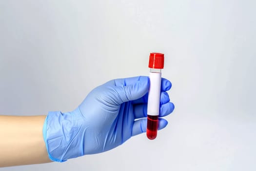 Doctor holding blood tube test in the research laboratory. health for check up . Generative ai.
