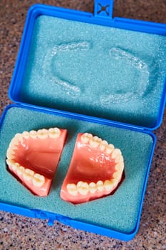 Detailed Close-up of Dentures in a Blue Case, Emphasizing Dental Health and Care in a Dentist Office, Fort Wayne, Indiana, 2017