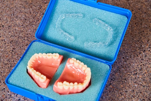 Dental Impression Models in Protective Case, Fort Wayne Dentist Office, 2017