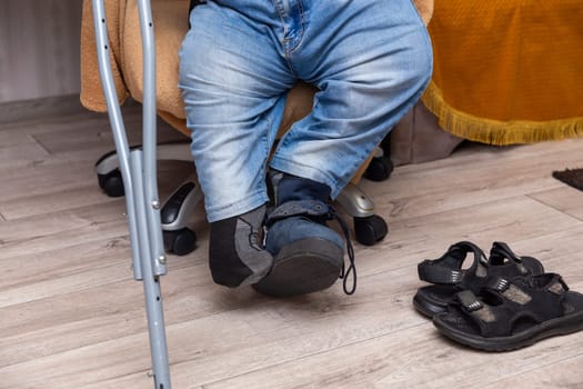 A person with a congenital disability puts on custom-made shoes to go outside. The injury does not allow him to use ordinary shoes.