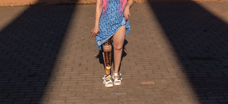 Beautiful young woman leg amputee in a dress walking in park at sunny day. Life goes on no matter what.