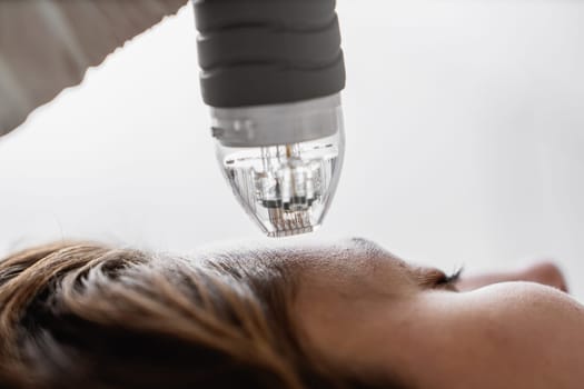 A woman receives a laser treatment on her face to enhance her complexion and appearance.