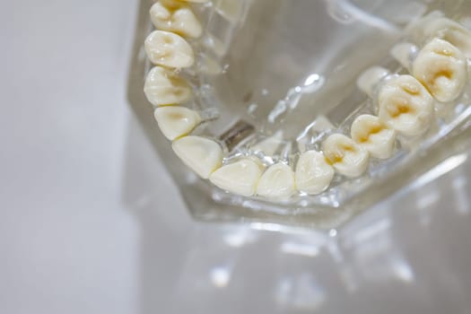 Model of human jaw. Selective Focus.