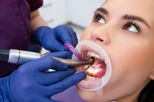 Proficient female dentist in gloves removes damaged part of tooth with dental drill. Cavities treatment process in private dental clinic