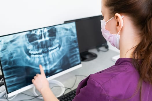 Dentist checks the X ray of the teeth in dentist office.