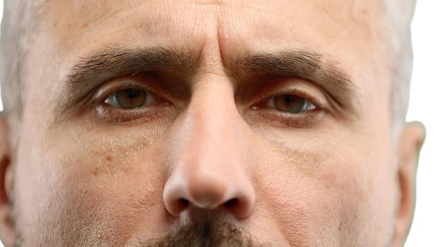Man's eyes, close-up, on a white background.