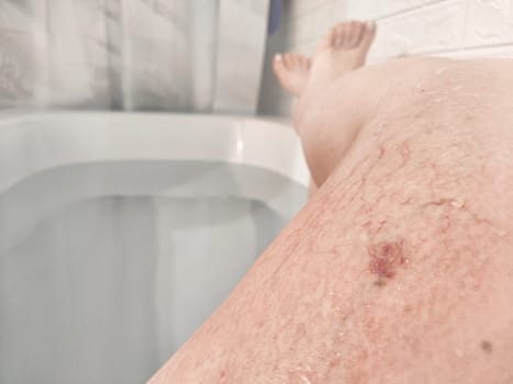 Close-Up of Varicose Veins on a Leg in the Bathtub. Leg with varicose veins while submerged in bathtub, highlighting the health condition