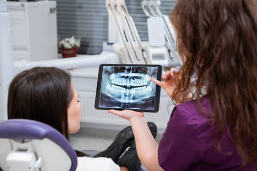 Showing the patient the X-ray, the female dentist explains the treatment concept during the discussion