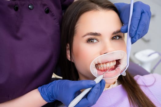 Close up of beautiful female smile with white teeth during medical examination