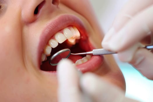 Dental treatment. Close up of female at dentist office, getting check up. Generative AI.