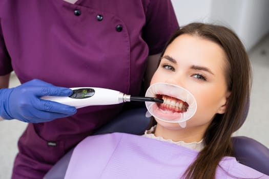 Doctor dentist fixes a filling in teeth using UV lamp to a beautiful patient.