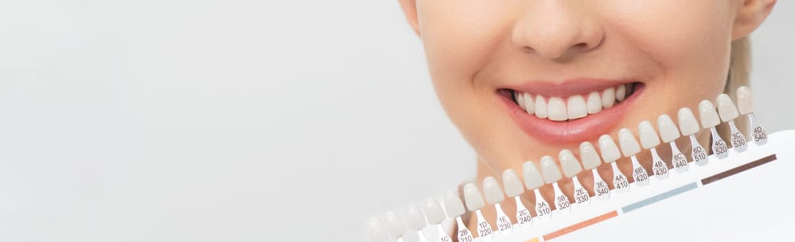 Teeth whitening process. Set of implants with various shades of tone. Dental care.