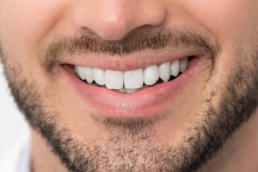 Man with perfect smile. Teeth whitening, dental care concept