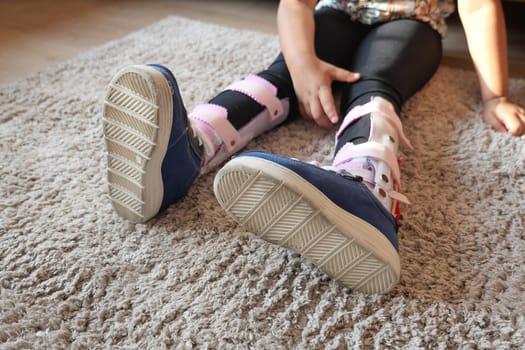 Child with orthopedic shoes sitting on carpet ,