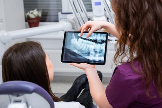 A female dentist discusses treatment options with the patient while displaying the X ray
