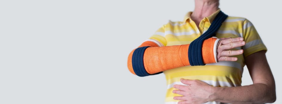 woman with broken right arm wearing plaster casts to hold broken bones in place until they heal,hanging her arm in a sling, modern treatments, on a neutral background,copy space, High quality photo