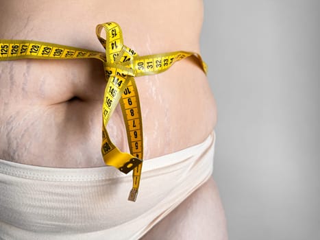 Body positivity and self love concept with yellow measuring tape tied in bow around womans stomach showing stretch marks on neutral background. High quality photo